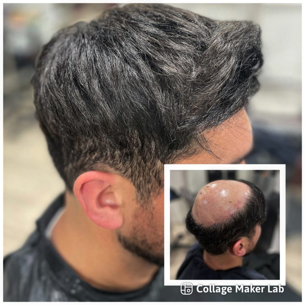 latelier-du-cheveu90 - photos avant et après d'un homme avec compléments capillaires