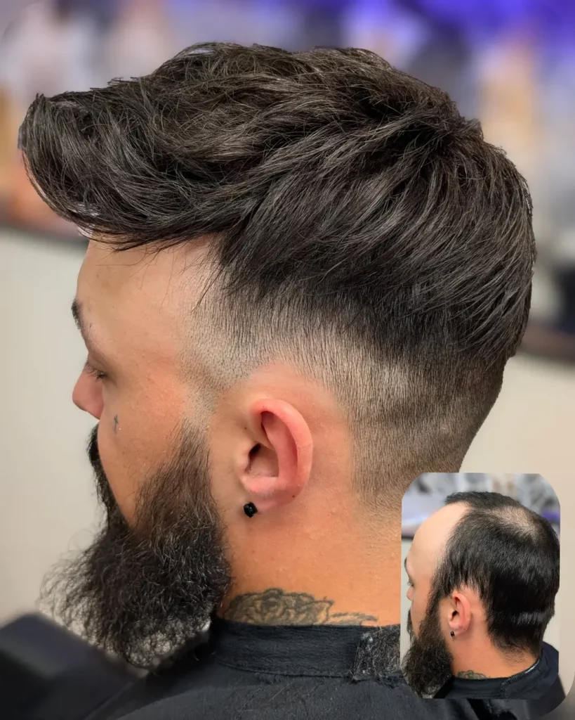 latelier-du-cheveu90 - photos avant et après d'un homme avec compléments capillaires