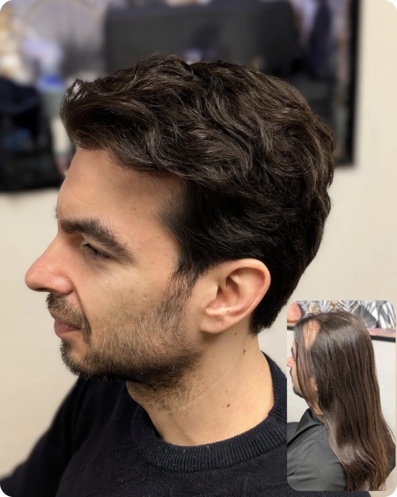 latelier-du-cheveu90 - photos avant et après d'un homme avec compléments capillaires